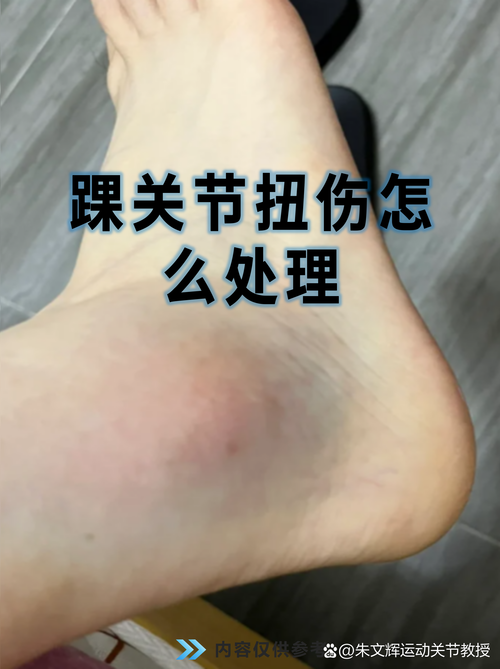 巴黎官方：巴尔科拉右脚踝严重扭伤，可能无法出战欧冠14决赛